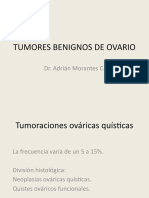 Tumores Ovario Benignos