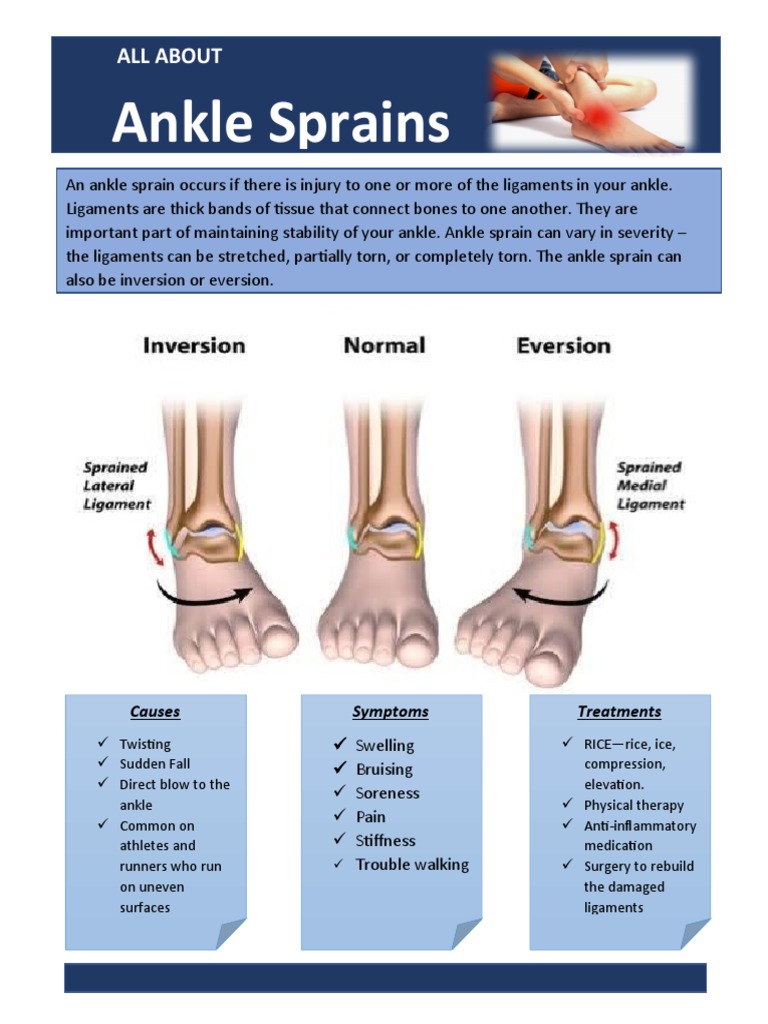 Understanding Ankle Sprains and Treatments | PDF