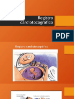 Registro Cardiotocográfico
