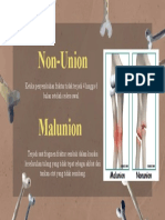 Union Mal Union (Moza)