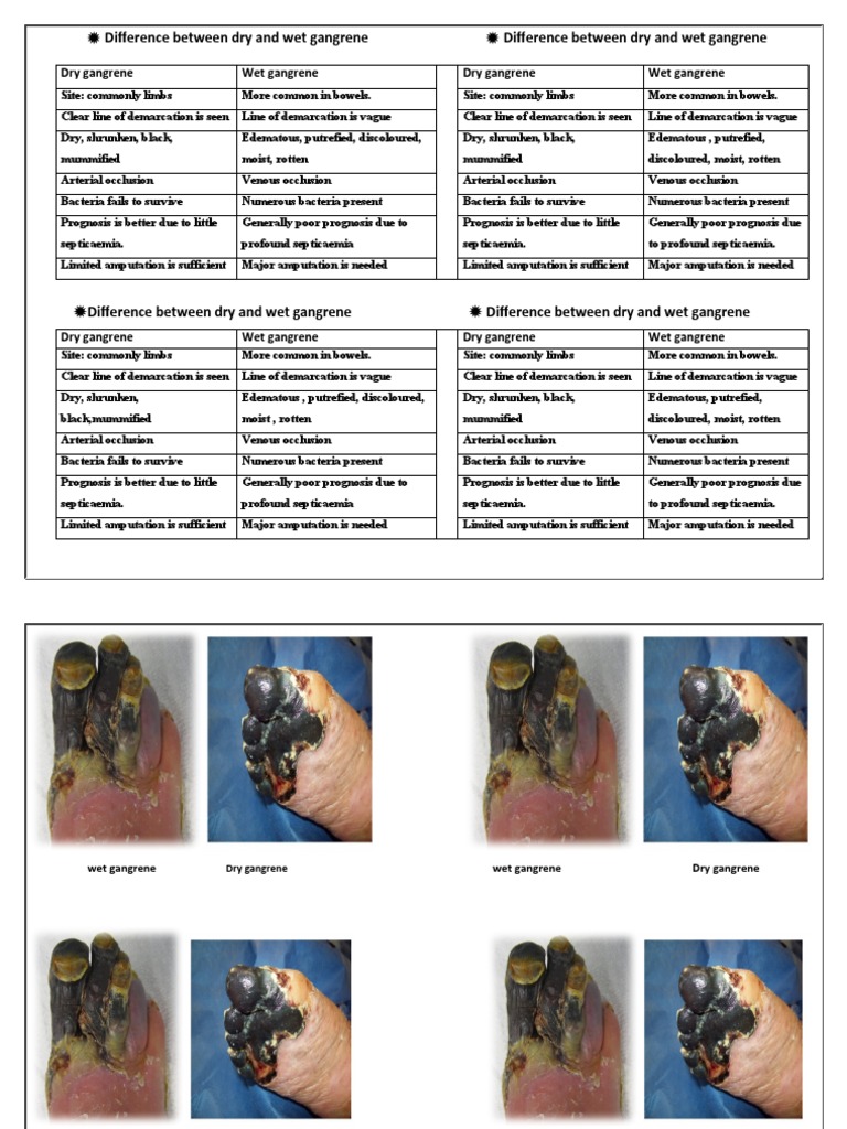Line Of Demarcation Gangrene