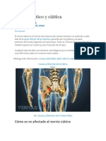 Nervio Ciático y Ciática