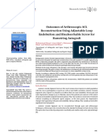 Outcomes of Arthroscopic ACL