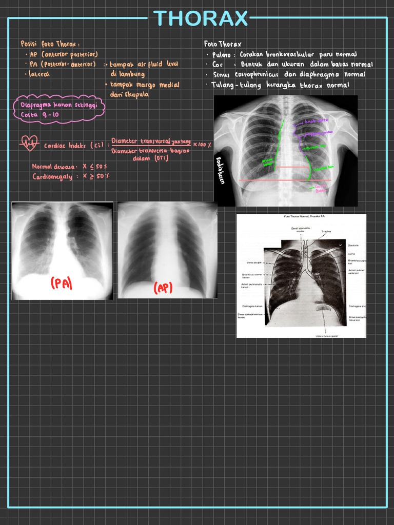 Foto Thorax Normal dan Anatomi | PDF