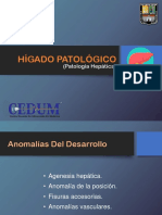 Higado Patologico