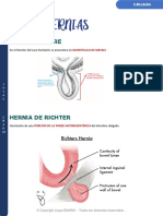 4.4 Otras Hernias (Litre, Richter, Obturatriz)