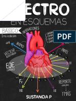 EKG en Esquemas