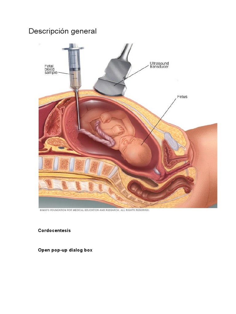 Cordocentesis: Diagnóstico Prenatal Seguro | PDF | Especialidades ...