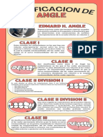 Clasificacion de ANgle DYS