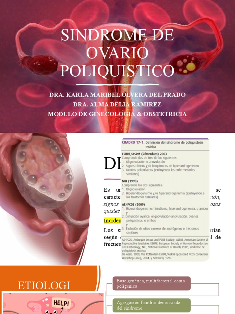 Sindrome Ovario Poliquistico | PDF | Reproducción | Anatomia sexual