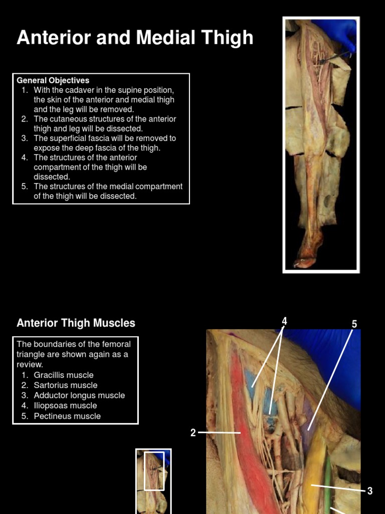 Anterior and Medial Thigh Dissection Guide | PDF | Human Leg ...