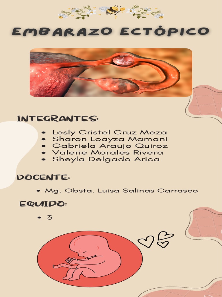 Embarazo Ectópico: Causas y Tratamiento | PDF | Especialidades Medicas ...