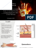 Quemaduras e Injerto Cutaneo