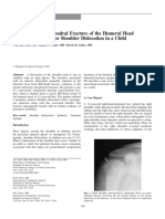 Pediatric Humeral Head Fracture After Shoulder Dislocation