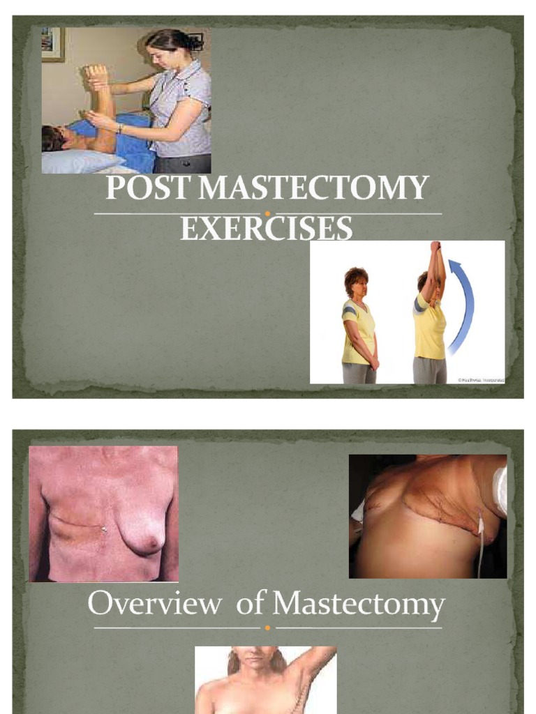 Post Mastectomy Exercises Pp Pdf Mastectomy Surgical Specialties