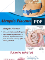 Abruptio Placenta-1