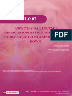 Leucemia megacarioblástica aguda: aspectos e correlação com a síndrome de Down