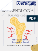 Tumores óseos: diagnóstico y clasificación