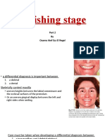 Finishing Stage Maxillary Cant Correction