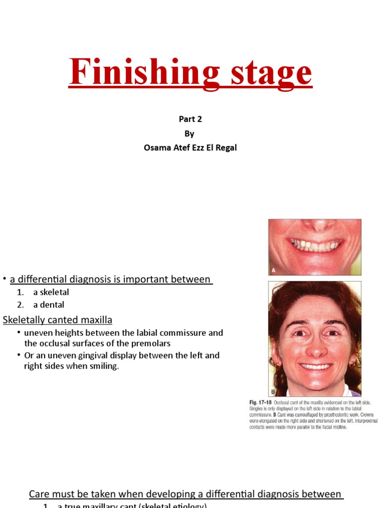 Rowboat Effect in Orthodontic Finishing | PDF | Orthodontics ...
