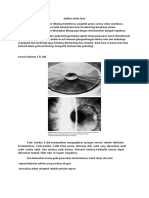 Ringkasan Aplikasi Laser Dan Kornea