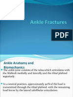 Ankle Fractures 19542969