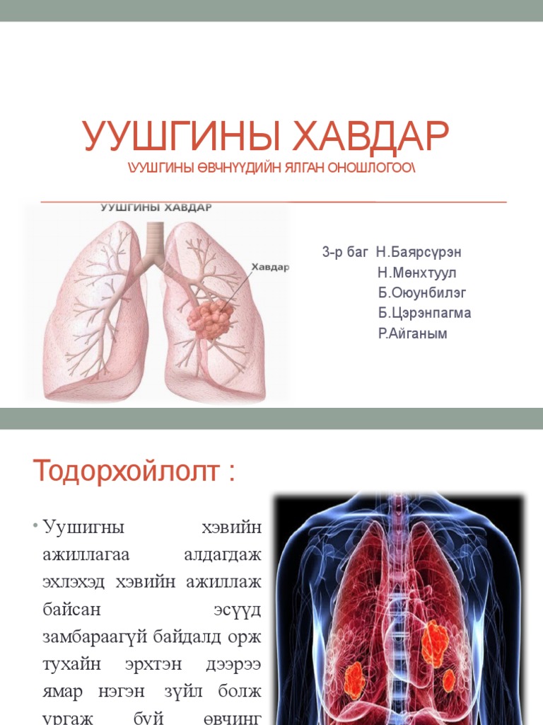 Уушгины Хавдар Бие Даалт | PDF