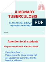 Pulmonary Tb