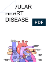 Valvular Heart Disease