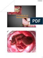 Etiología de La Maloclusiones