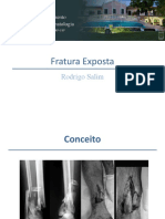 Fratura Exposta