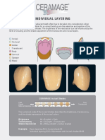 Ceramage layering guide