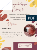 Conjuntivitis Por Chlamydia