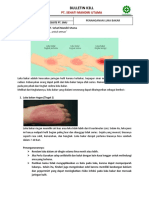 5.1 Bulletin K3LL - Penangan Luka Bakar