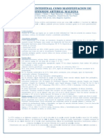 Perforación intestinal por hipertensión arterial