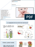 Corrección de Las Fisuras Labio Palatinas