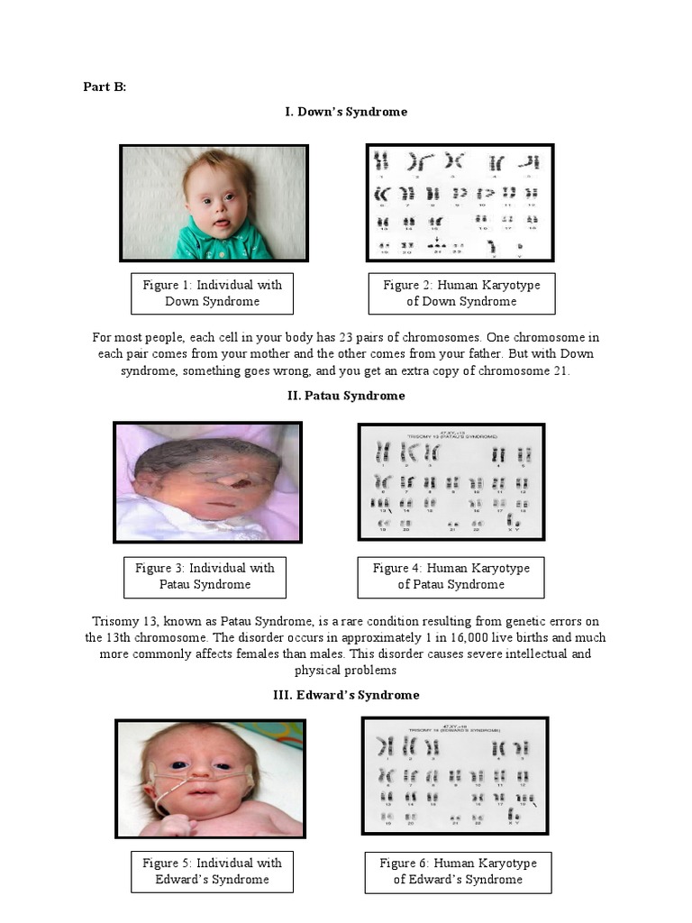 Chromosomal Abnormalities Pdf Karyotype Clinical Medicine