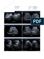 Ultrassonografia Do Abdome Superior (Série de Impressão-Imagens)