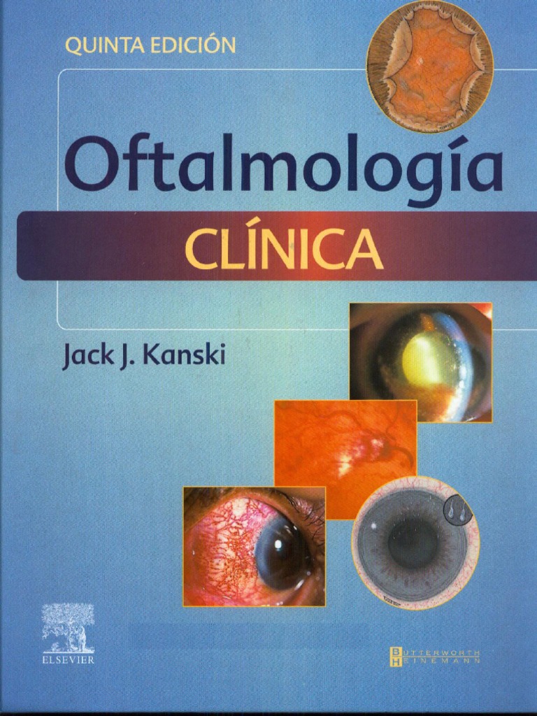 KANSKI. Oftalología Clínica. 5° Edición | PDF