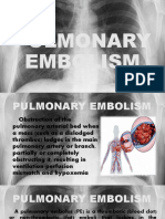 Pulmonary Embolism Guide: Causes, Symptoms & Treatment