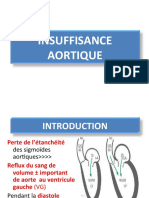 Insuffisance Aortique Short