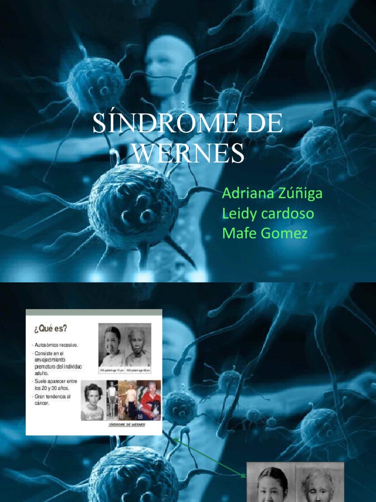 Síndrome de Werner | PDF