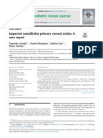 Impacted Mandibular Primary Second Molar A Case Report