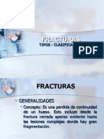 Fracturas