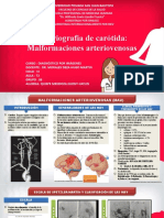 Quispe Mendoza - Arteriografía Malformaciones Arteriovenosas