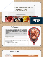 Ruptura prematura membranas (RPM