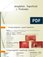 Faringoamigdalitis Superficial y Profundas