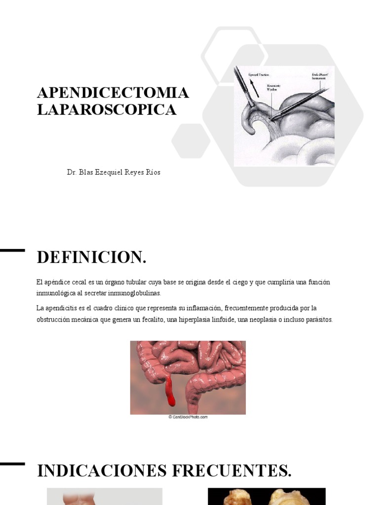 Apendicectomia Laparoscopica | PDF | Gastroenterología | Especialidades ...