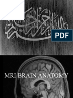 MRI BRAIN ANATOMY