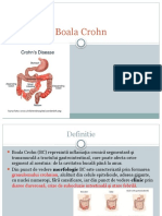 Boala Crohn